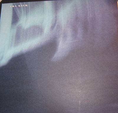 S/T